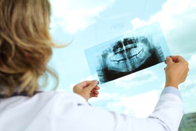 Are Dental X-rays Safe?
